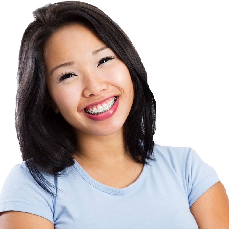 clear-braces-2 Clear braces