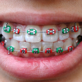 Colored Braces photo