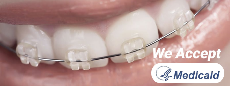 medicade-orthodontics-banner https://pgorthodontics.com/wp-content/uploads/2025/04/medicade-orthodontics-banner.jpg