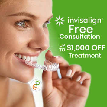 Invisalign Free Consultation - Up to $1000 Off Treatment