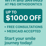 Invisalign $1000 off offer - Henderson & Las Vegas